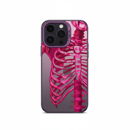 Pink skeleton iPhone case with purple bumper